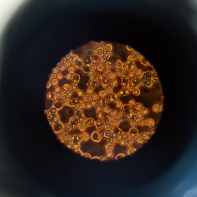 Microscope image of cells